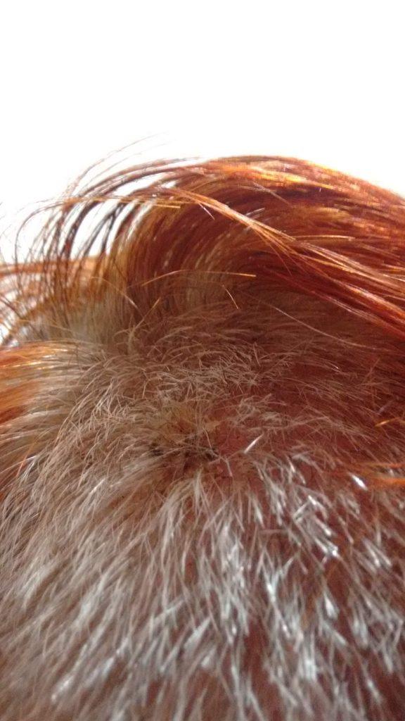 Needle in my Brain PART2 – Ausstellung